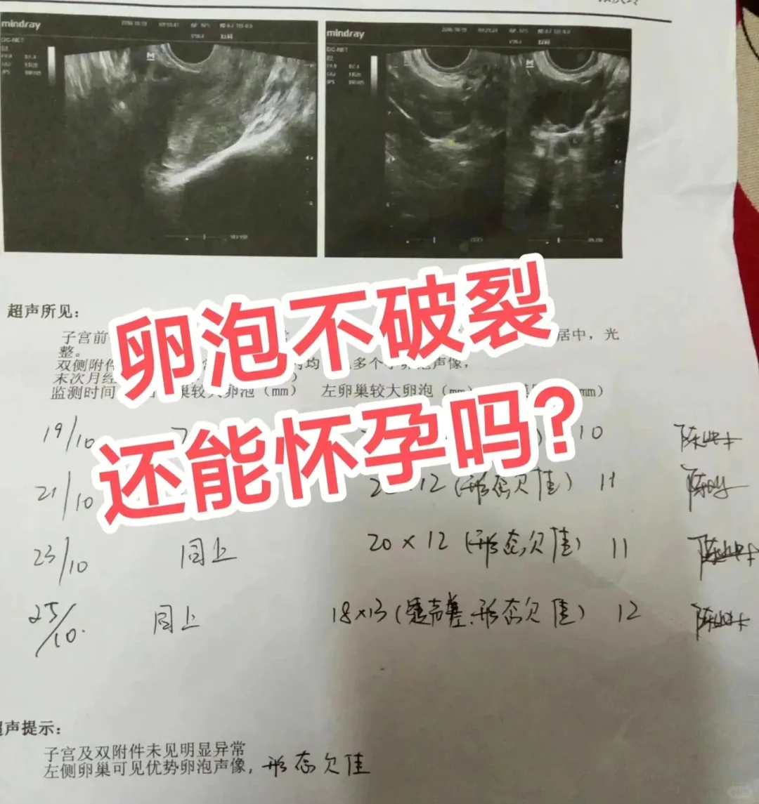 为什么促排后卵泡仍不破裂？解析原因与应对策略